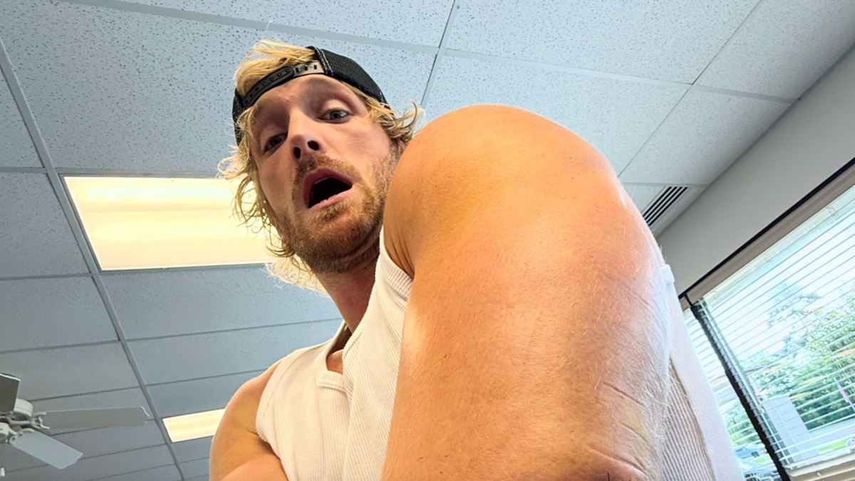 Logan Paul Shows Off Gnarly Scar After Undergoing Tricep Surgery