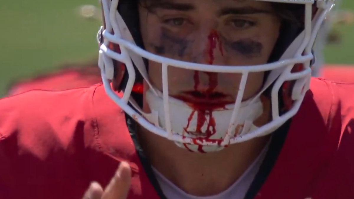 Josh Hoover Suffers Bloody Injury During Indiana's Season Opener