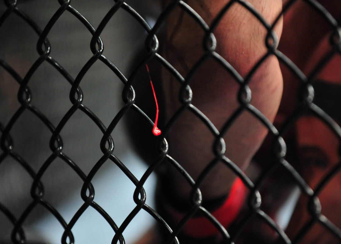 MMA Fighter Disqualified For Biting Opponent's Ear, Sparks Crowd Brawl